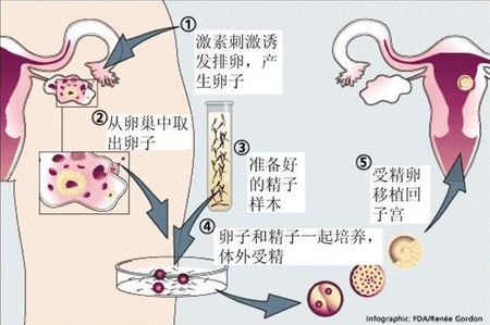 关于青碧生殖
